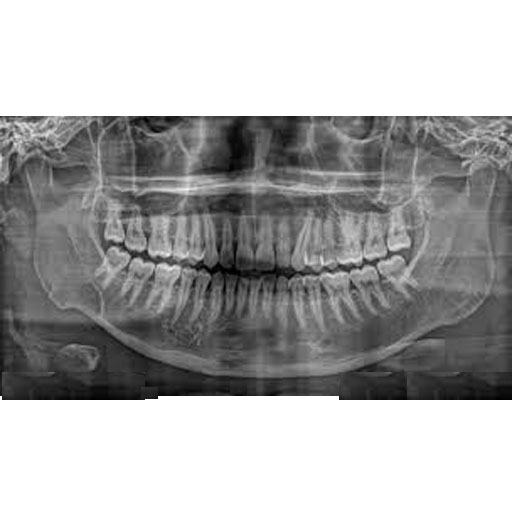 radiografia panoramica